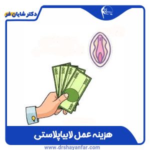 هزینه عمل لابیاپلاستی