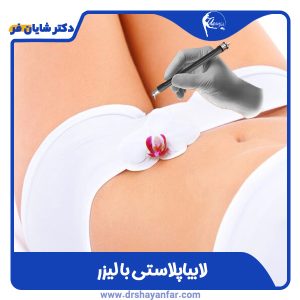لابیاپلاستی با لیزر