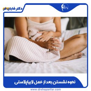 نحوه نشستن بعد از عمل لابیاپلاستی