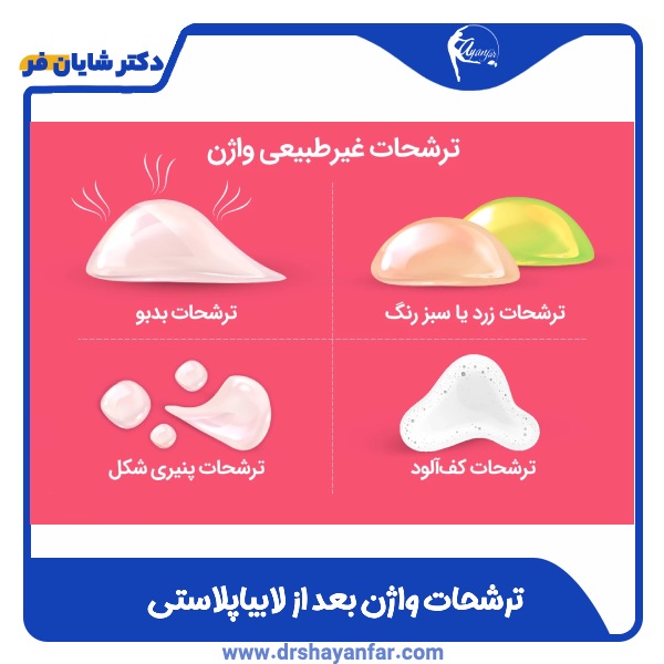 ترشحات واژن بعد از لابیاپلاستی