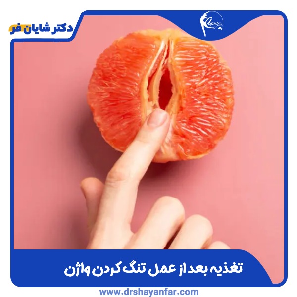 تغذیه بعد از عمل تنگ کردن واژن