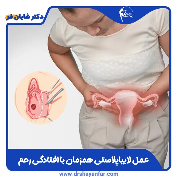 عمل لابیاپلاستی همزمان با افتادگی رحم