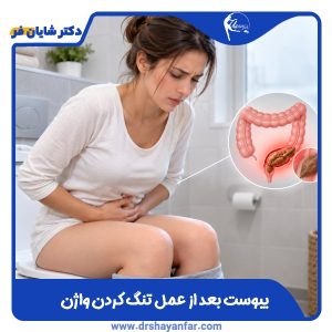 یبوست بعد از عمل تنگ کردن واژن