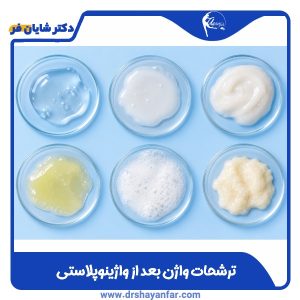 ترشحات واژن بعد از واژینوپلاستی